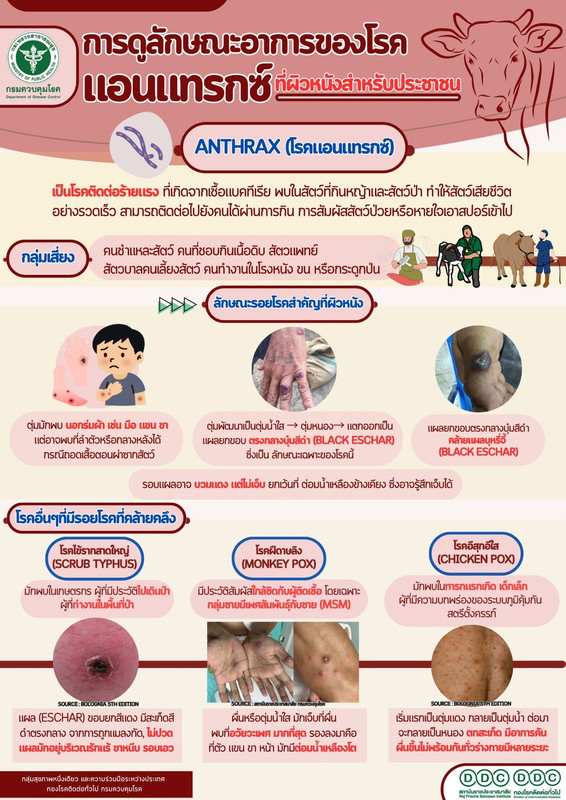 ลักษณะอาการของโรคแอนแทรกซ์ที่ผิวหนัง