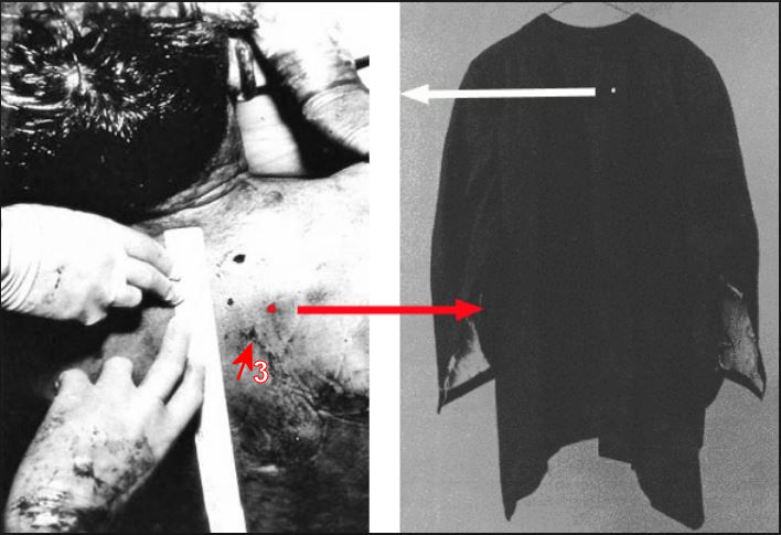 jfk-backwound-comparison-jacket-wound.jp