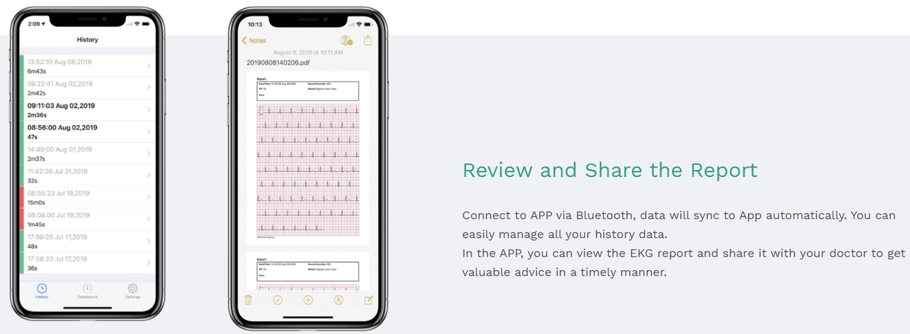 • Wellue DuoEK Wearable EKG/ECG Monitor 