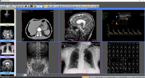 [Image: Sante-DICOM-Editor-7-9-3.png]