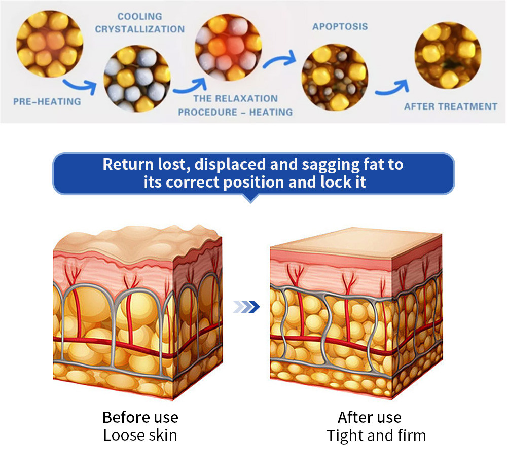 Before and after skin structure: loose vs tight and firm