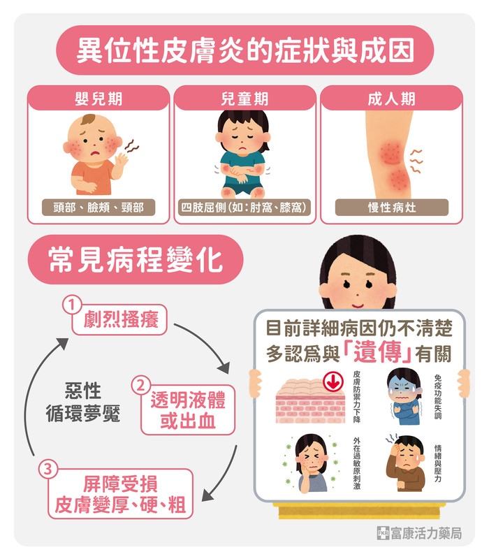 認識異位性皮膚炎的症狀與成因