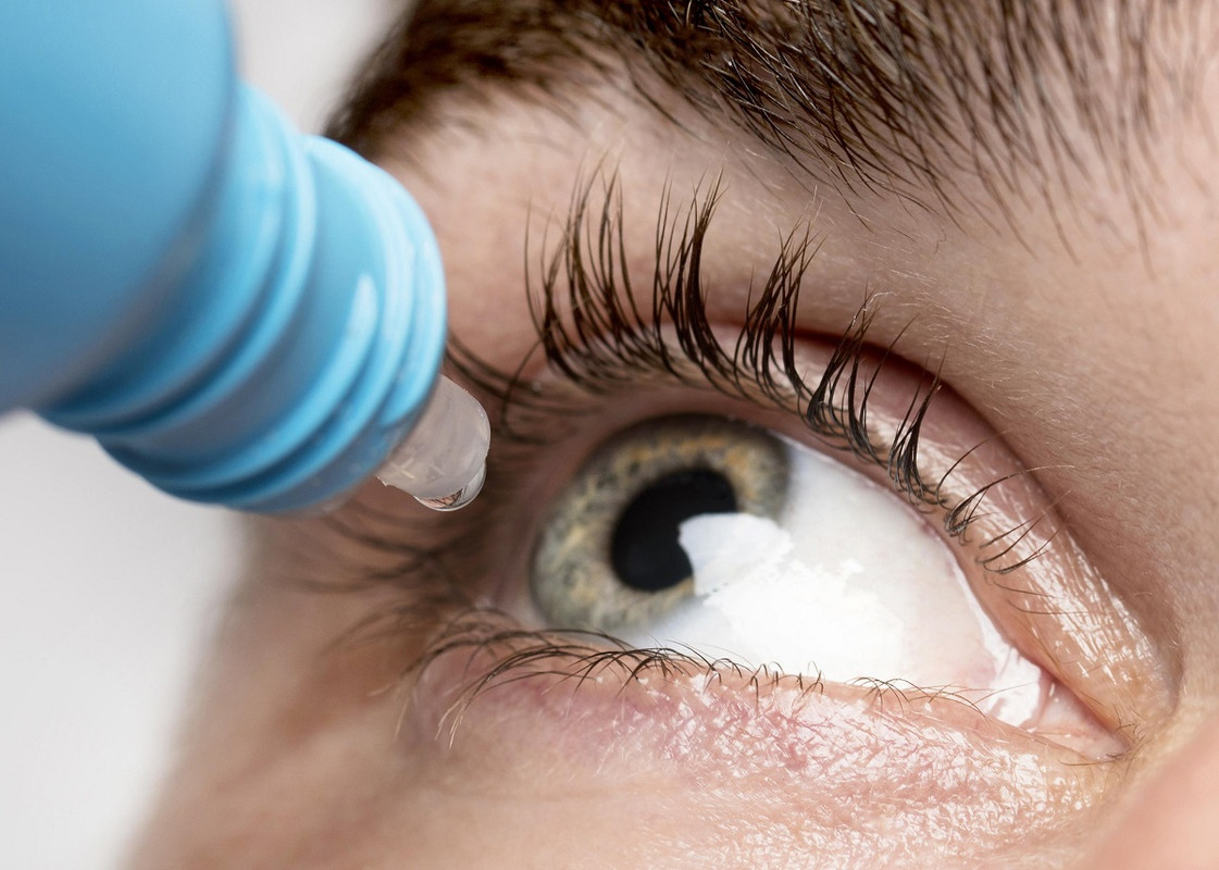 dry eye specialist