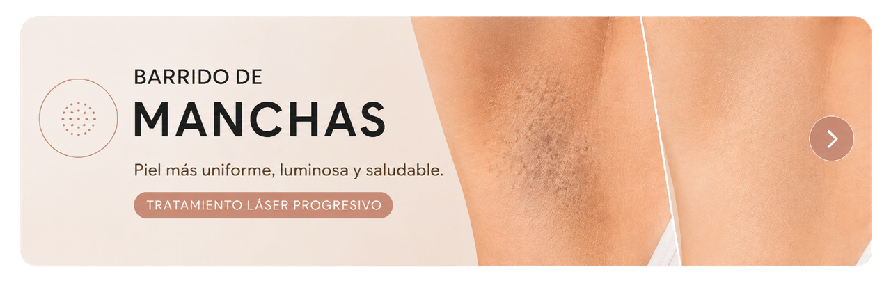 Banner barrido de manchas con láser en BELDAD Studio