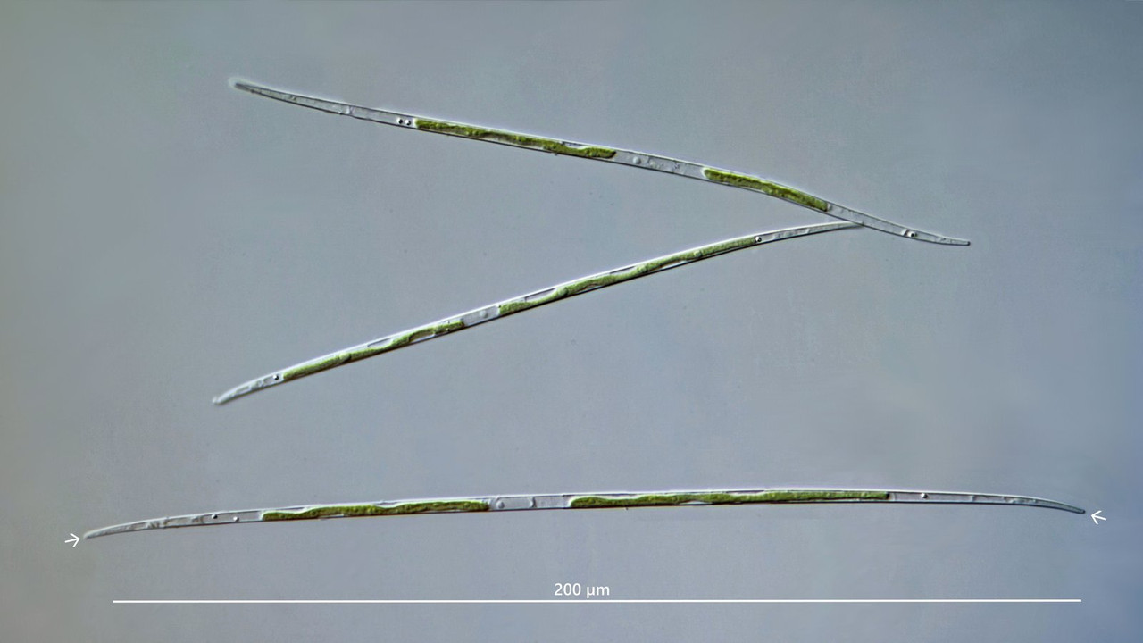 Closterium 51 pronum Spindel-Alge DIK 100 (0,8x) Potzenberg
