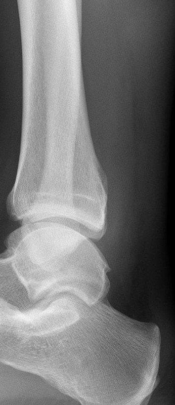 Orthopedics question 10 image