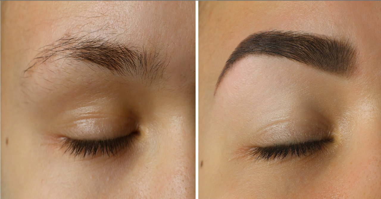 ¿Qué es un injerto de cejas? La solución definitiva para las cejas calvas