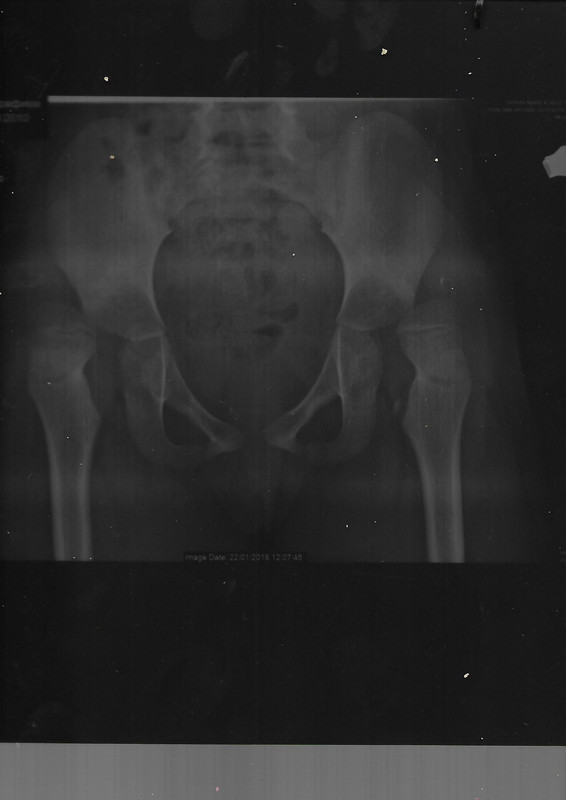 рентген от 22.01.2018