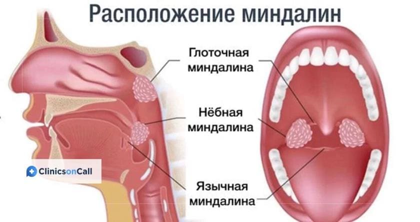 Нёбные миндалины
