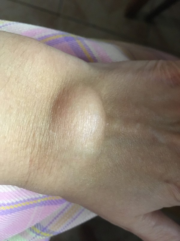 305EDC64-44E9-4817-BAF2-9F125ACAD78A