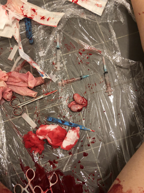 461BF1C6-A765-4BC6-BDC1-BF83E8DF5346