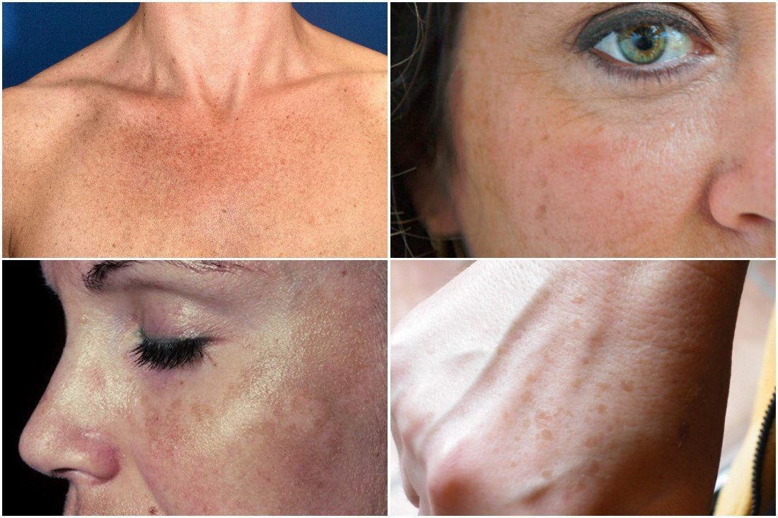 SAVE_20180621_103958