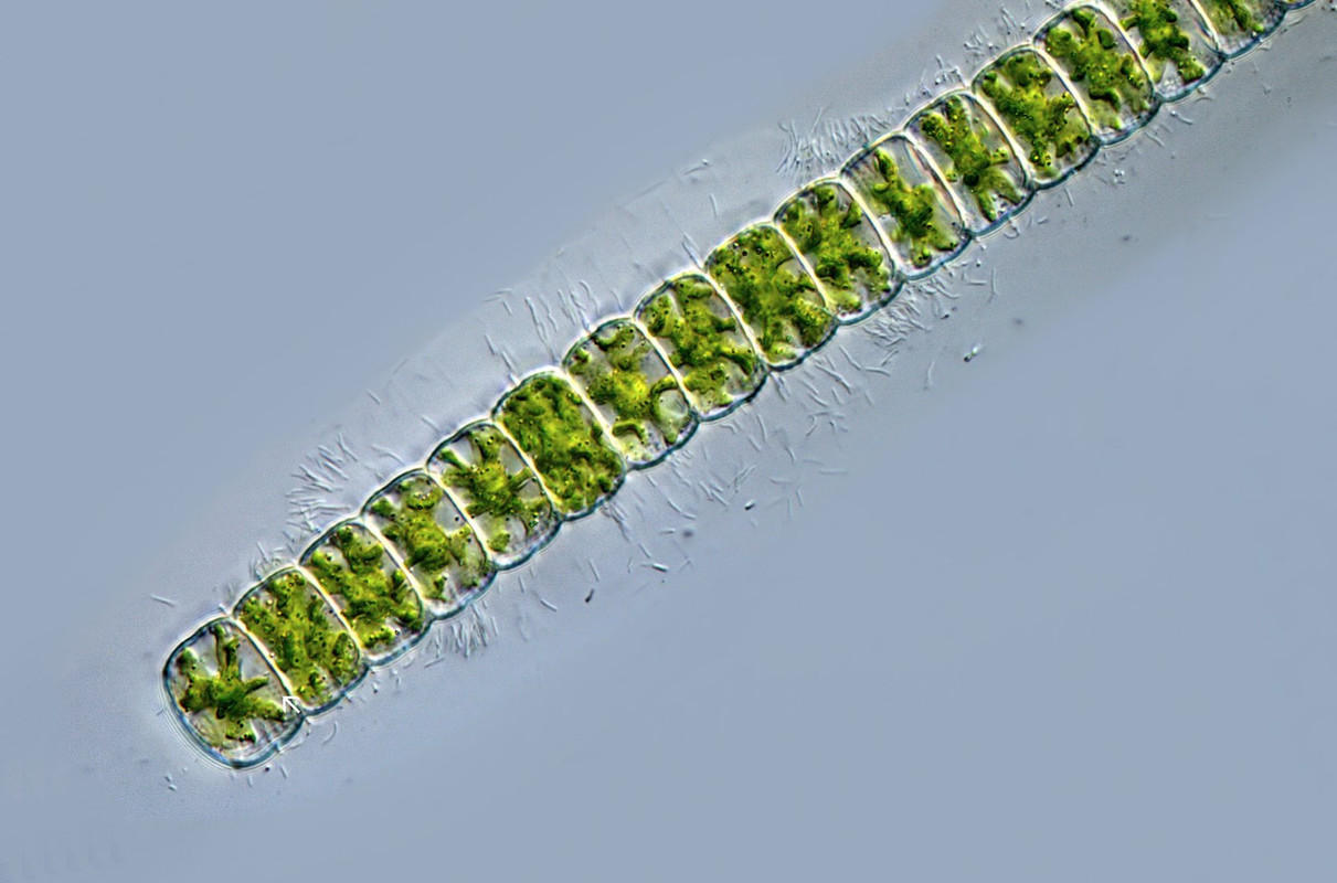 Hyalotheka 01 dissilens Glashüllen-Alge Apikale Poren (Pfeil) Giglachsee DIK 100