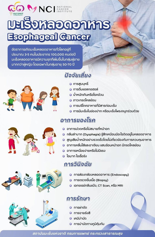ระวัง โรคมะเร็งหลอดอาหาร ภัยเงียบที่ผู้สูงวัยควรใส่ใจ