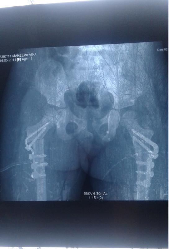 снимок 2016г тбс