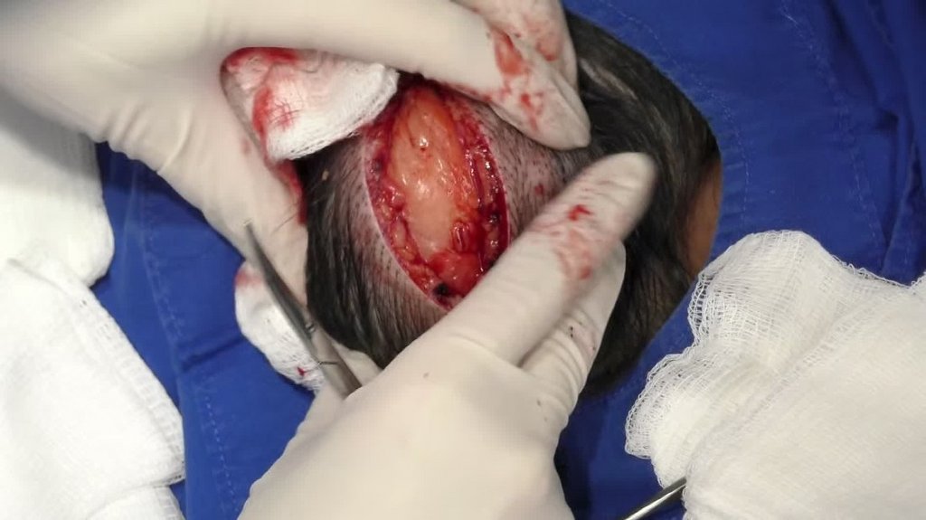 [Image: ors17f68owbj.jpg]