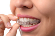 Clear Aligners (Invisalign & others)