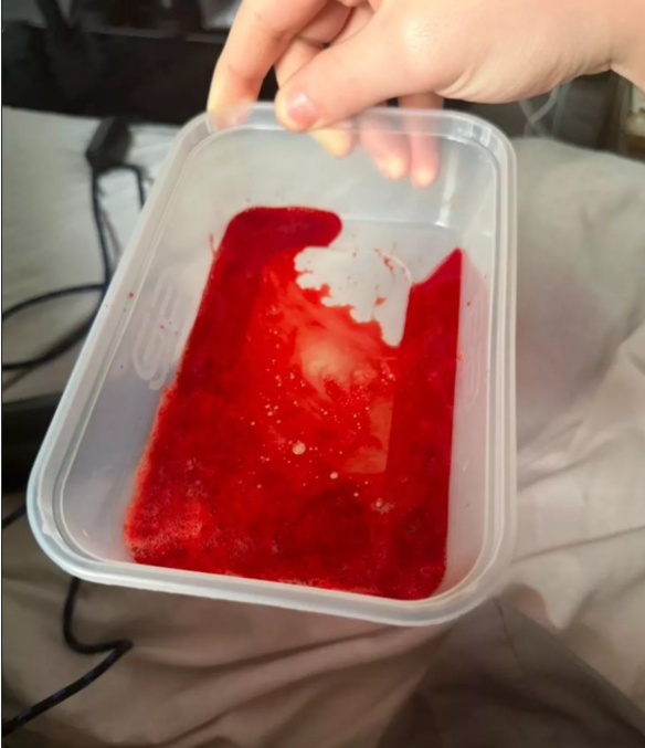 Jayden initially thought the blood was due to eating too many kebabs Kennedy News and Media