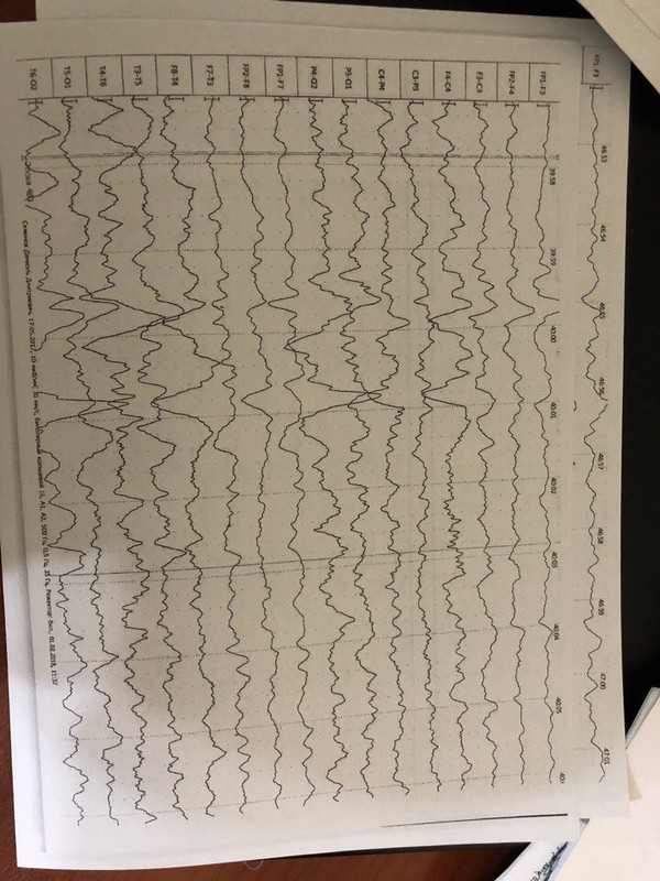 E0E3519A-7E65-4836-AA95-961662864D6C