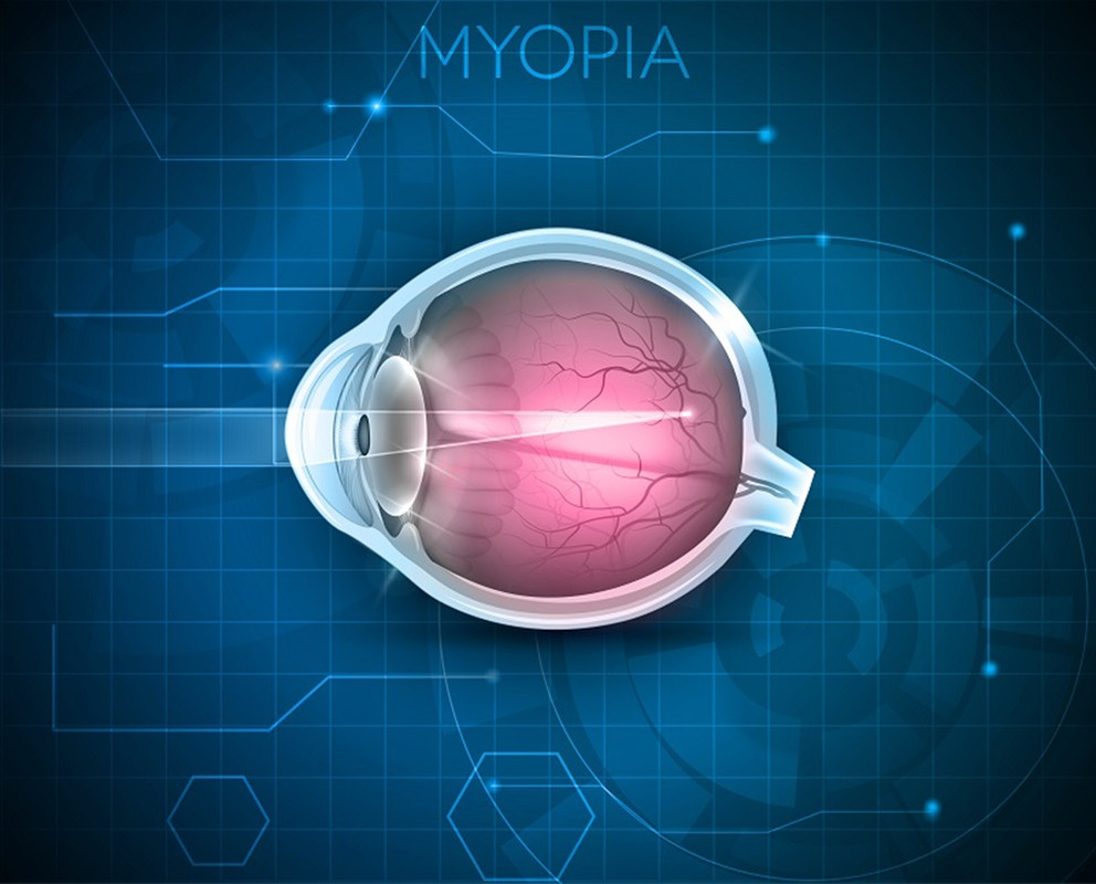 myopia control melbourne