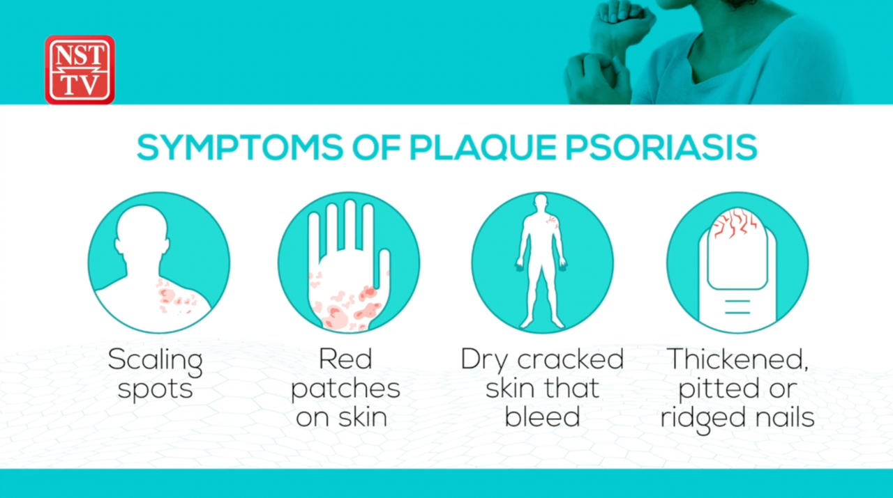 A look at psoriasis and how to manage it