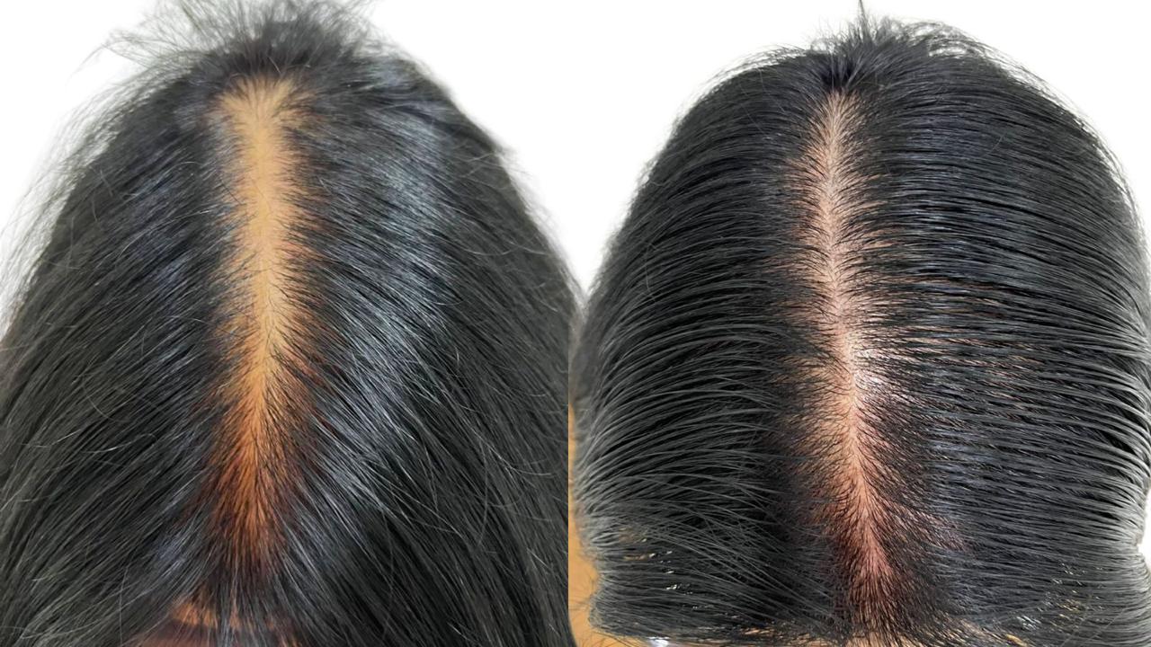 Resultado de Tratamento