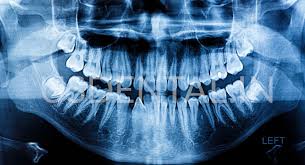 Cellular Dosimetry and the Biological Mechanisms Dictating Whether Are Dental X-Rays Safe