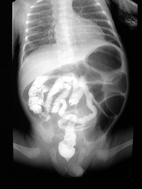 Pulmonology question 8 image