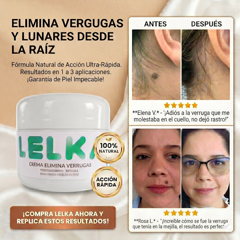 Crema LELKA Elimina Verrugas
