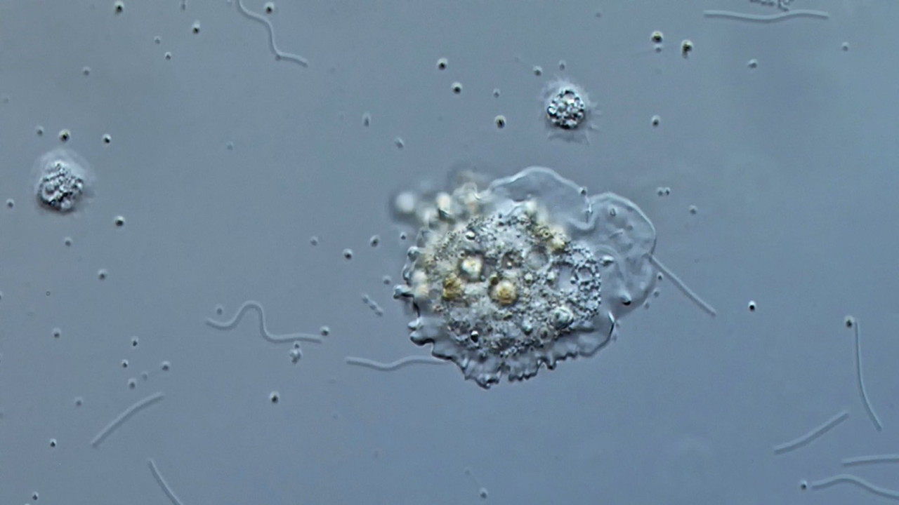 Cochliopodium 03 bilimbosum Schnecken-Amöbe DIK 50-Z7