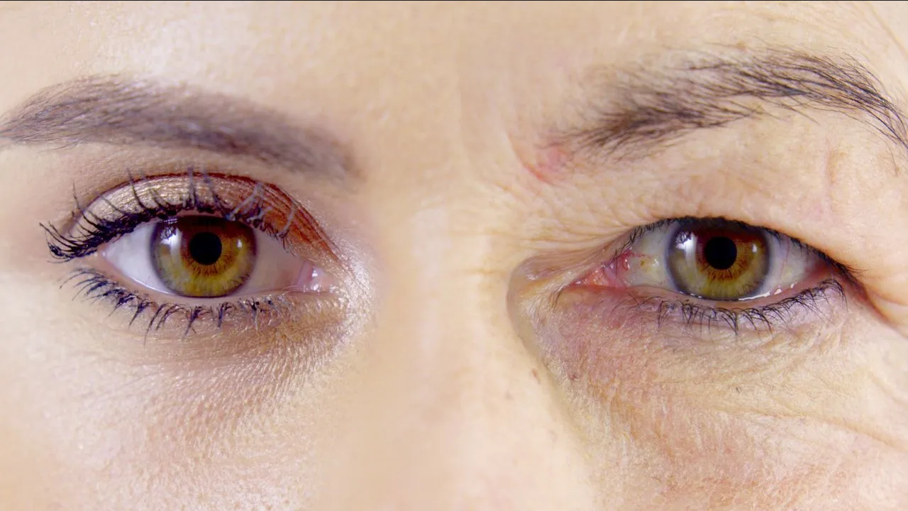 Estos son los 5 remedios para levantar los párpados caídos de forma natural