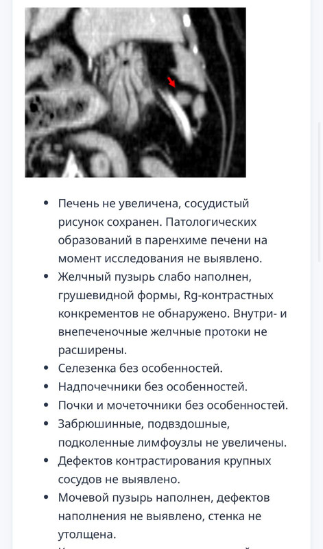 КТ 02