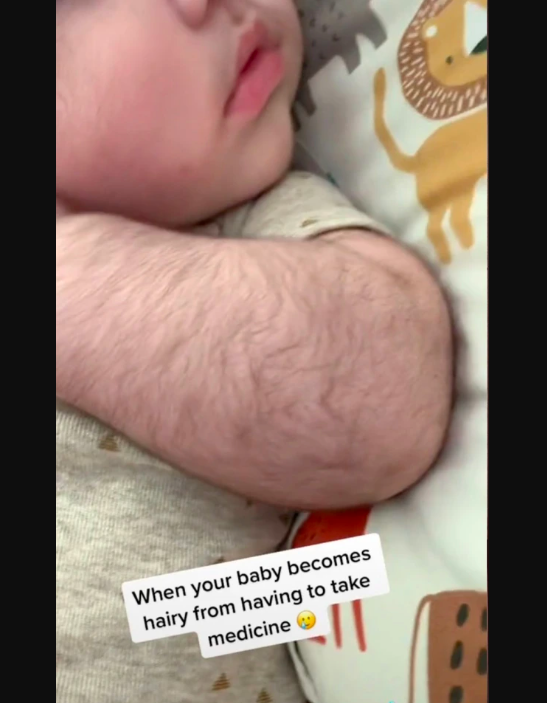 Mamá da medicamento a su bebé y este se vuelve super peludo; ya es viral