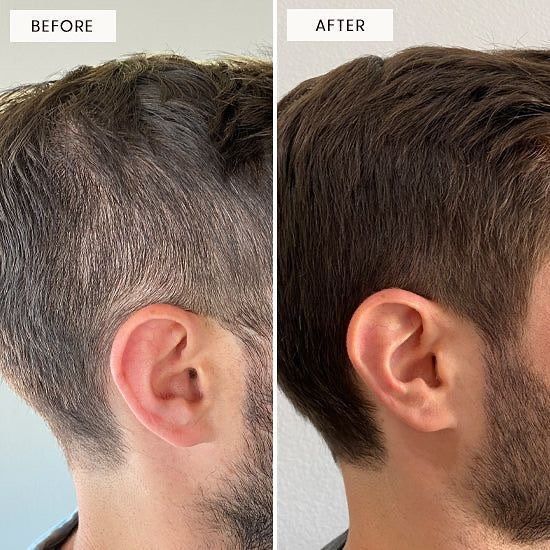 Cambio NovaHair 5