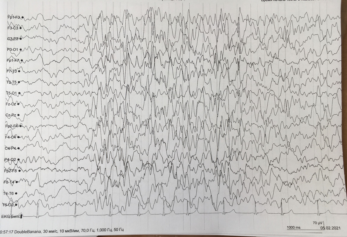 3C93772D-1F13-41AF-BBF1-B6AF3CFB46F3