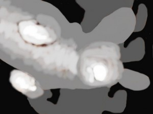 20190110-114915-depth