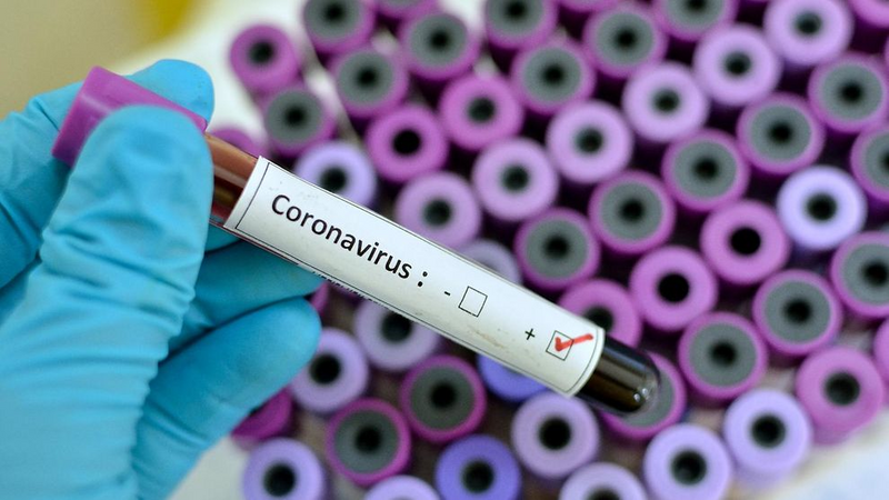 Koronės marmalizacija: naujas ginklas, kuris žudo kiekvieną dieną
