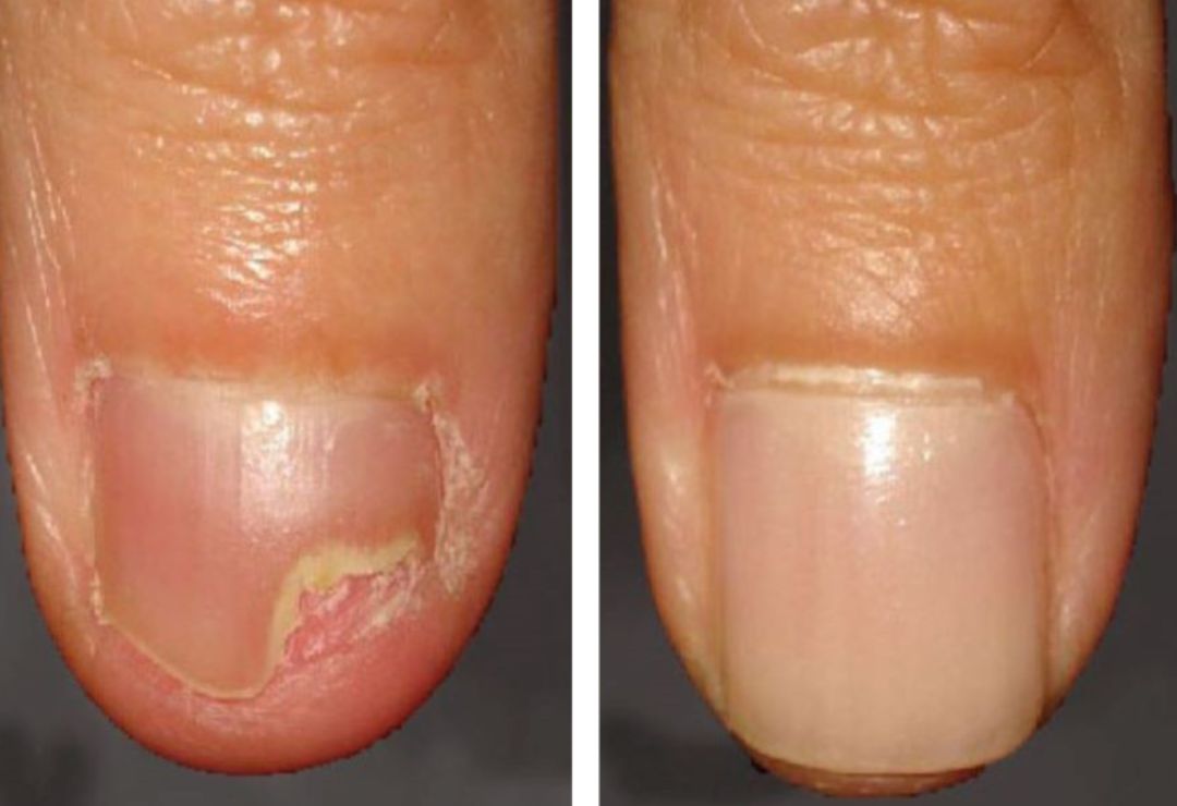 Depoimento cliente Micovax
