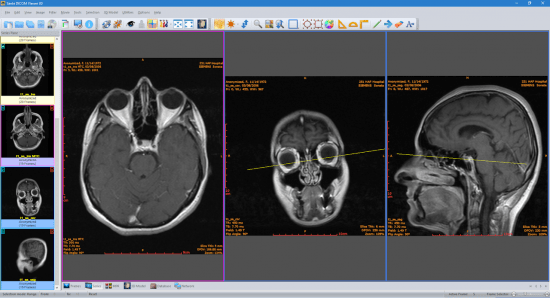 Sante DICOM Viewer 3D Pro v4.9.4