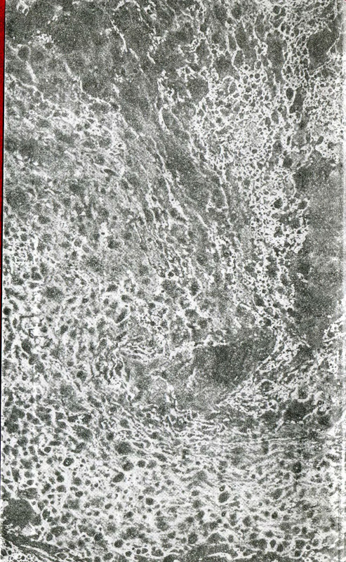 p0002