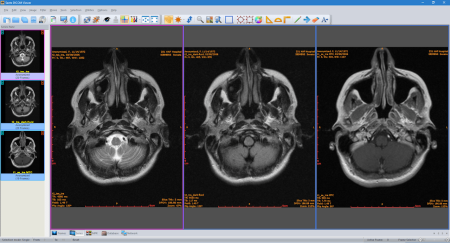 Sante DICOM Viewer Pro 12.1.7