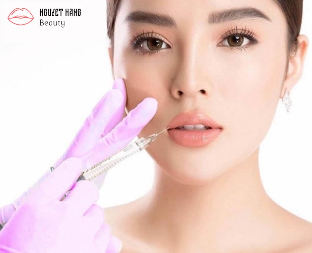 Tiem-filler-01-Nguyet-Hang-Beauty.jpg