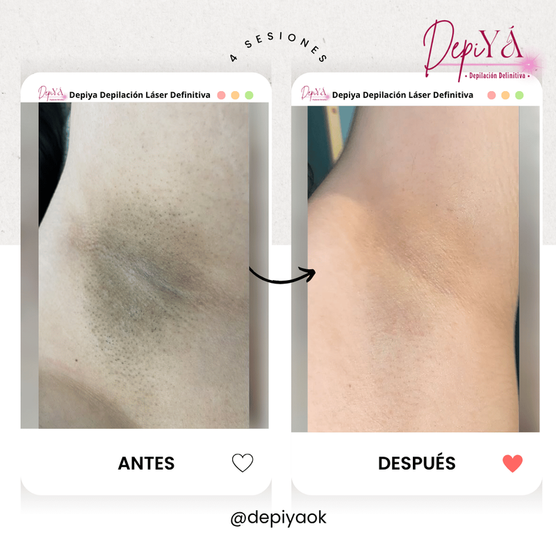 Antes y después 3