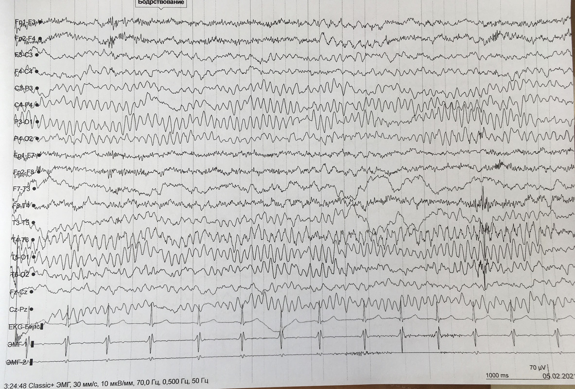 AEADD1E9-8D38-4A17-ADB9-DBFAE8AFFE17