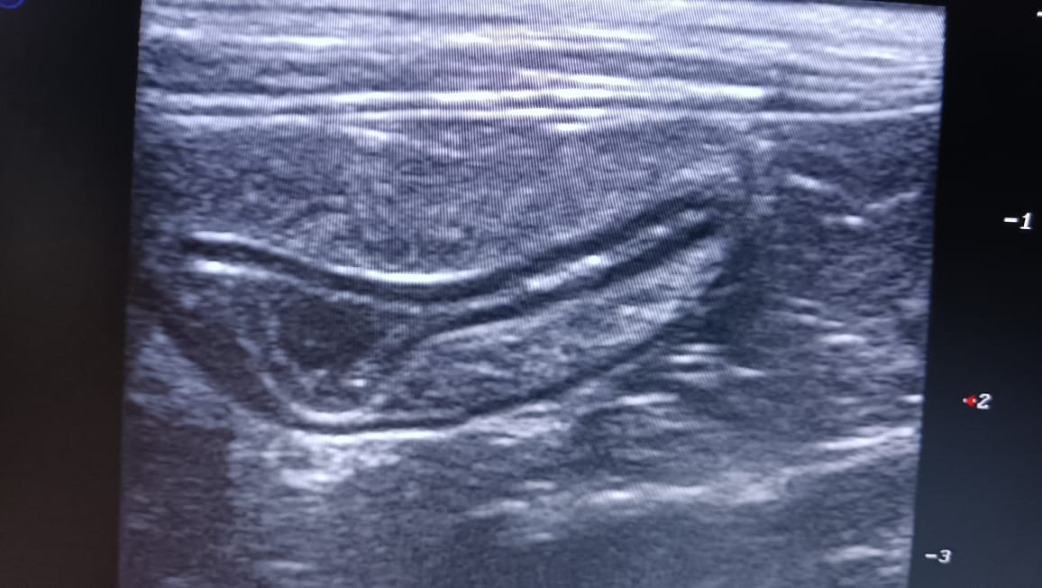 217A4EE6-47FC-450B-9666-3F3F5F2C053E