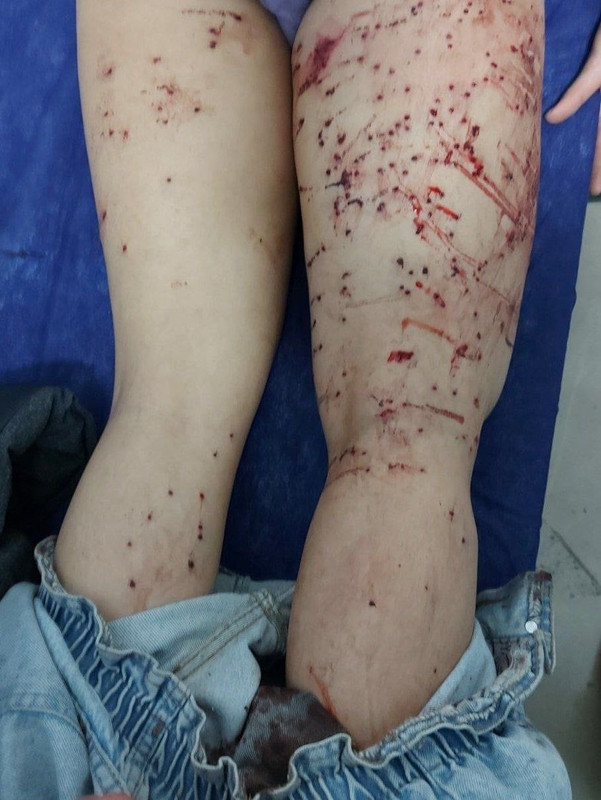 ۲۰۲۲۱۱۲۵_۱۱۳۶۰۴