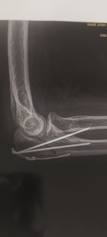 xray3