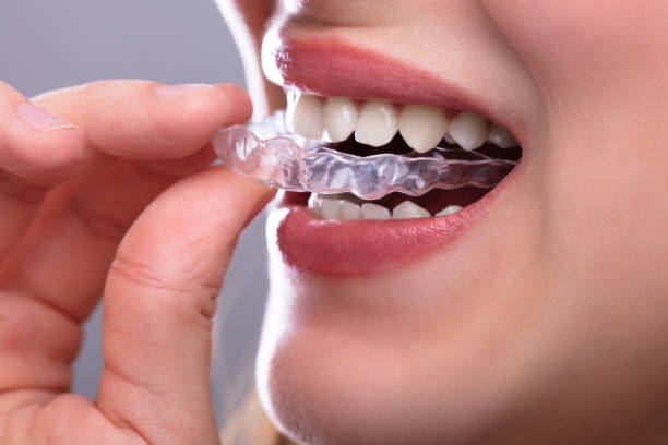 Invisalign Treatment In Middletown