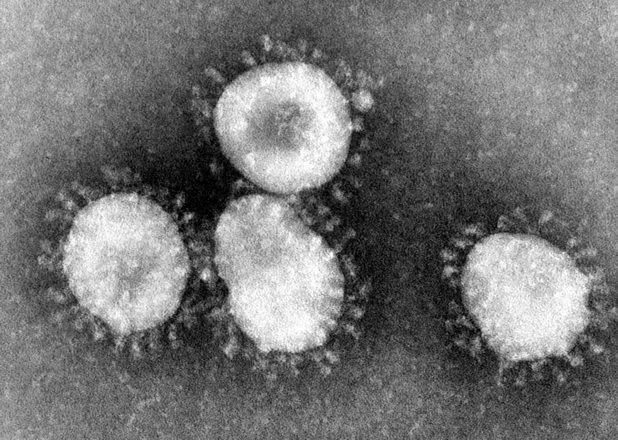 https://i.postimg.cc/85zzjvNw/Coronaviruses-004-lores-redimensionner.jpg