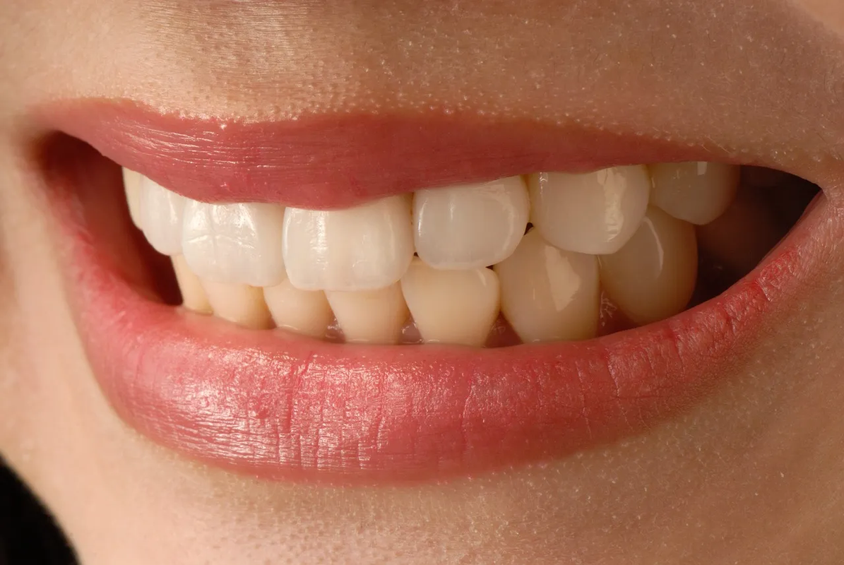 ¿Tus dientes están amarillos? Mejora tu sonrisa con este remedio casero
